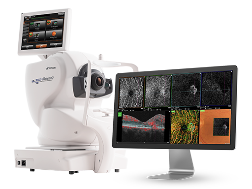 Topcon Maestro2 OCT-A system with example retinal blood-vessel scans